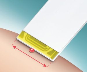 Wider dosing area